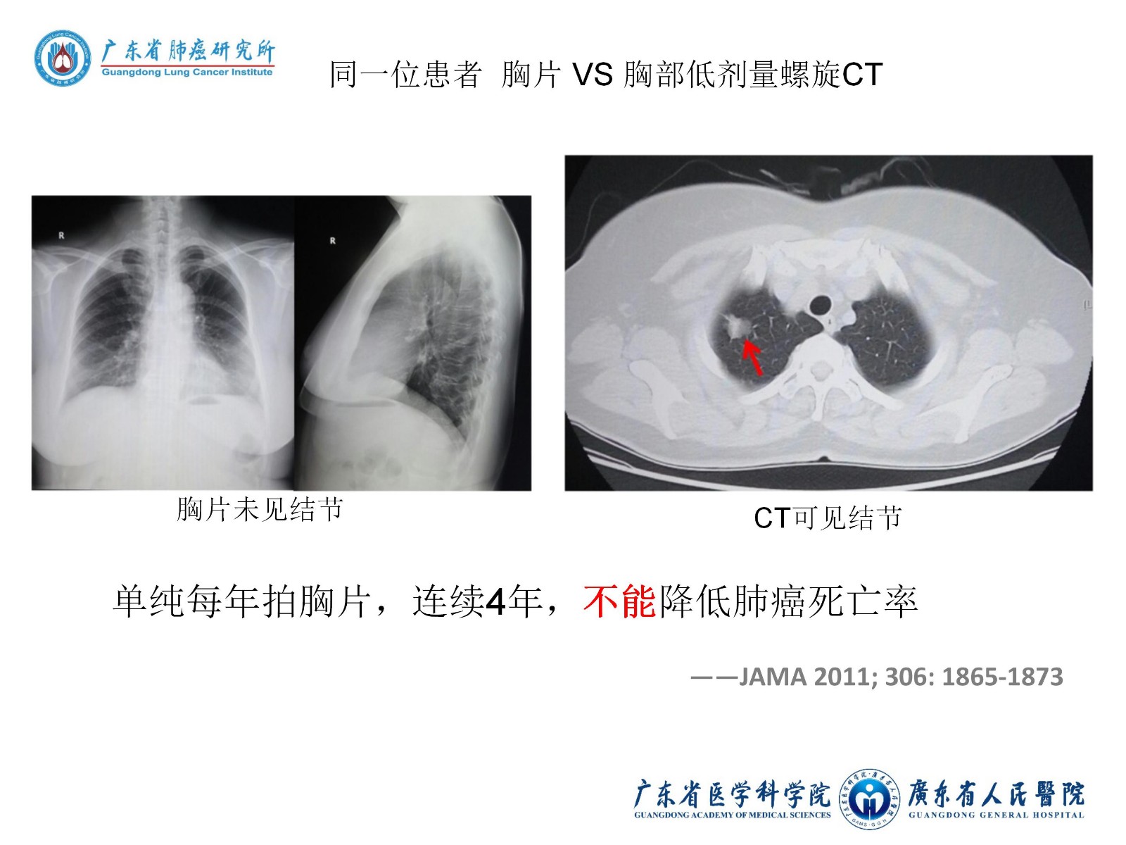 OkIat6Ua1ubht011.jpg