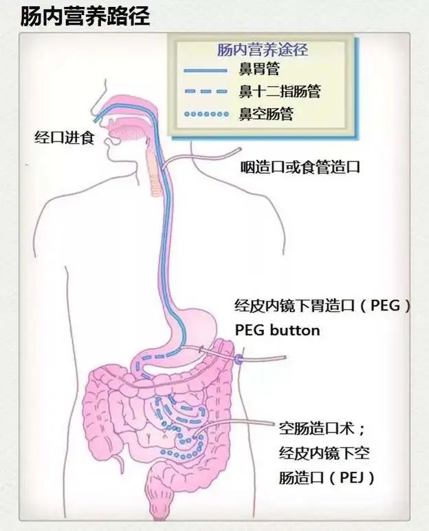 d40e73bbcce59bc1b2f4434bb771716c.jpg