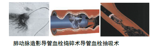 截图202207100129449711.png