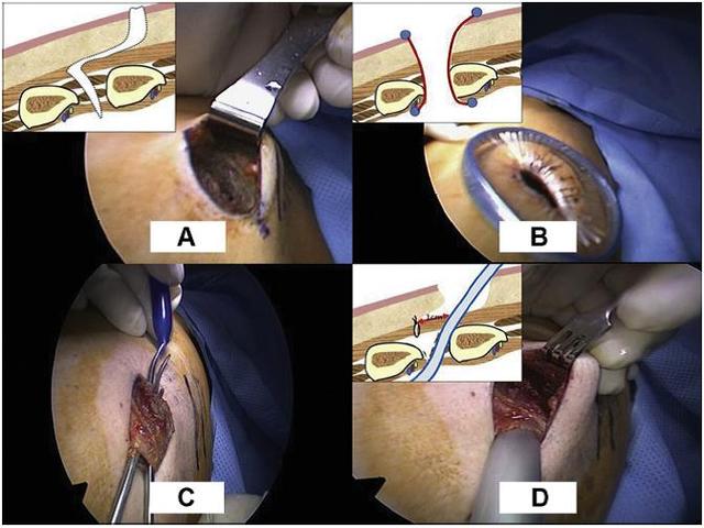 215316u8vn18h1zj1k9ppi.jpg