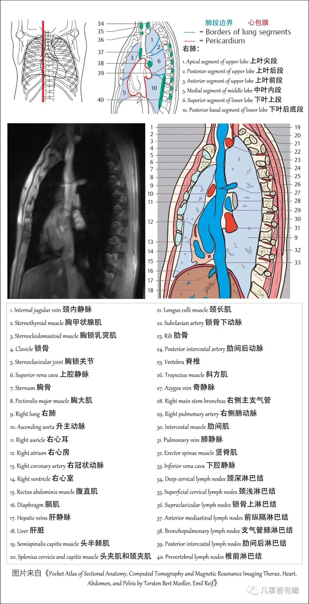 b203fd9a43d46f86da11cdc78b05889b.jpg