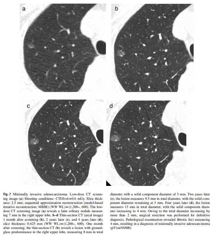 be0117c2c2d465274848f355714df1ef.png